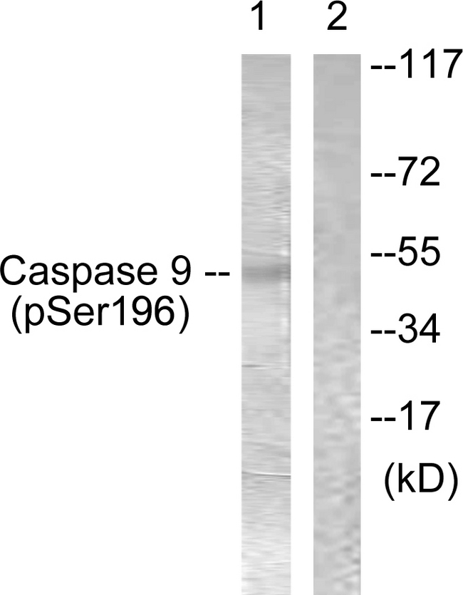 CASP9 / Caspase 9 Antibody - Western blot analysis of lysates from 293 cells treated with Calyculin 50nM 30', using Caspase 9 (Phospho-Ser196) Antibody. The lane on the right is blocked with the phospho peptide.