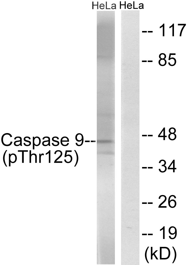 CASP9 / Caspase 9 Antibody - Western blot analysis of lysates from HeLa cells treated with TNF 20ng/ml 5'+calyculinA 50ng/ml 5', using Caspase 9 (Phospho-Thr125) Antibody. The lane on the right is blocked with the phospho peptide.