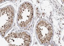 CASP9 / Caspase 9 Antibody - 1:100 staining human Testis tissue by IHC-P. The tissue was formaldehyde fixed and a heat mediated antigen retrieval step in citrate buffer was performed. The tissue was then blocked and incubated with the antibody for 1.5 hours at 22°C. An HRP conjugated goat anti-rabbit antibody was used as the secondary.