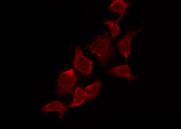 CASP9 / Caspase 9 Antibody - Staining HeLa cells by IF/ICC. The samples were fixed with PFA and permeabilized in 0.1% Triton X-100, then blocked in 10% serum for 45 min at 25°C. The primary antibody was diluted at 1:200 and incubated with the sample for 1 hour at 37°C. An Alexa Fluor 594 conjugated goat anti-rabbit IgG (H+L) Ab, diluted at 1/600, was used as the secondary antibody.