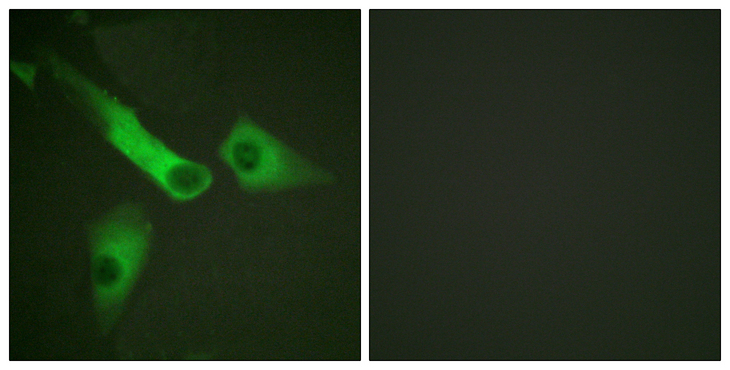 CASP9 / Caspase 9 Antibody - Immunofluorescence analysis of HepG2 cells, using Caspase 9 (Phospho-Tyr153) Antibody. The picture on the right is blocked with the phospho peptide.
