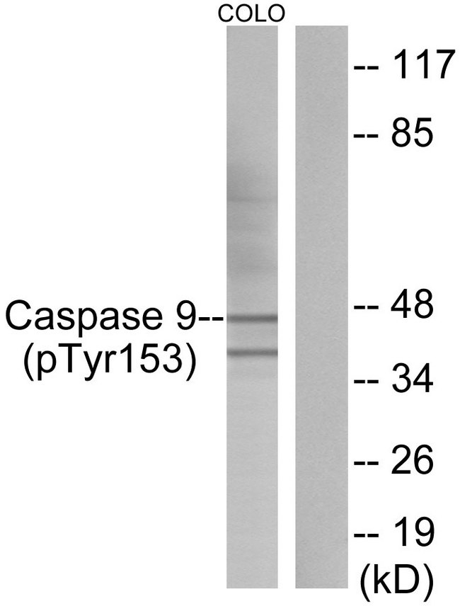 CASP9 / Caspase 9 Antibody - Western blot analysis of lysates from COLO205 cells, using Caspase 9 (Phospho-Tyr153) Antibody. The lane on the right is blocked with the phospho peptide.