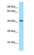 CASQ1 / Calsequestrin 1 Antibody - CASQ1 / Calsequestrin 1 antibody Western Blot of Fetal kidney.  This image was taken for the unconjugated form of this product. Other forms have not been tested.