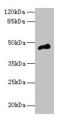 CASQ1 / Calsequestrin 1 Antibody - Western blot All lanes: CASQ1 antibody at 5µg/ml + Mouse brain tissue Secondary Goat polyclonal to rabbit IgG at 1/10000 dilution Predicted band size: 45 kDa Observed band size: 45 kDa
