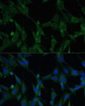 CASQ1 / Calsequestrin 1 Antibody - Immunofluorescence analysis of NIH/3T3 cells using CASQ1 Polyclonal Antibody at dilution of 1:100.Blue: DAPI for nuclear staining.