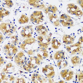 CASQ1 / Calsequestrin 1 Antibody - Immunohistochemistry of paraffin-embedded Human stomach using CASQ1 Polyclonal Antibody at dilution of 1:100 (40x lens).