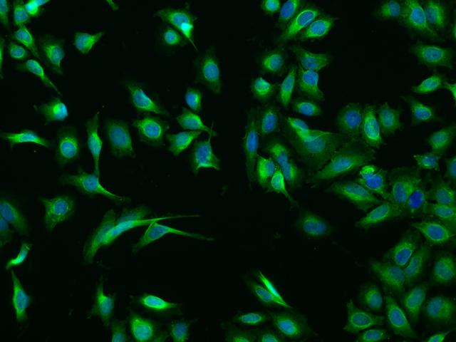 CASQ1 / Calsequestrin 1 Antibody - Immunofluorescence staining of CASQ1 in HeLa cells. Cells were fixed with 4% PFA, permeabilzed with 0.1% Triton X-100 in PBS, blocked with 10% serum, and incubated with rabbit anti-Human CASQ1 polyclonal antibody (dilution ratio 1:200) at 4°C overnight. Then cells were stained with the Alexa Fluor 488-conjugated Goat Anti-rabbit IgG secondary antibody (green) and counterstained with DAPI (blue). Positive staining was localized to Cytoplasm.
