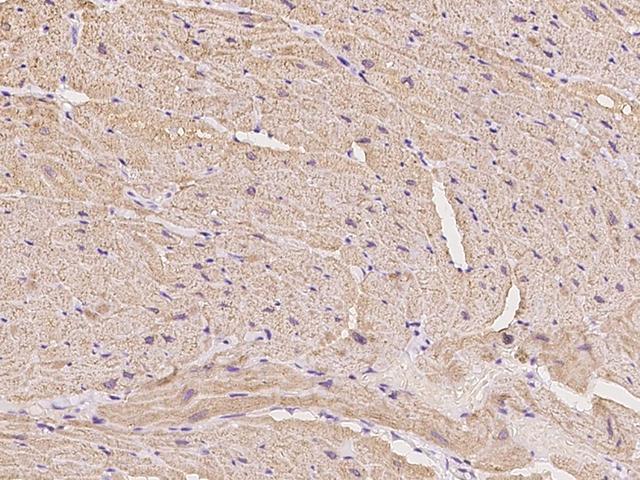 CASQ1 / Calsequestrin 1 Antibody - Immunochemical staining of CASQ1 in cynomolgus heart with rabbit polyclonal antibody at 1:300 dilution, formalin-fixed paraffin embedded sections.