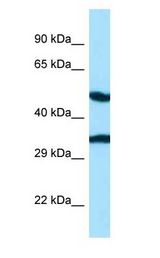CASQ2 / Calsequestrin 2 Antibody - CASQ2 / Calsequestrin 2 antibody Western Blot of Fetal Heart.  This image was taken for the unconjugated form of this product. Other forms have not been tested.