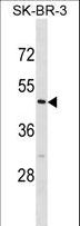 CASQ2 / Calsequestrin 2 Antibody - CASQ2 Antibody western blot of SK-BR-3 cell line lysates (35 ug/lane). The CASQ2 antibody detected the CASQ2 protein (arrow).