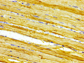 CASQ2 / Calsequestrin 2 Antibody - Immunohistochemistry image of paraffin-embedded human skeletal muscle tissue at a dilution of 1:100