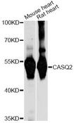 CASQ2 / Calsequestrin 2 Antibody - Western blot analysis of extracts of various cell lines, using CASQ2 antibody at 1:1000 dilution. The secondary antibody used was an HRP Goat Anti-Rabbit IgG (H+L) at 1:10000 dilution. Lysates were loaded 25ug per lane and 3% nonfat dry milk in TBST was used for blocking. An ECL Kit was used for detection and the exposure time was 1s.