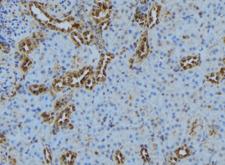 CASQ2 / Calsequestrin 2 Antibody - 1:100 staining mouse kidney tissue by IHC-P. The sample was formaldehyde fixed and a heat mediated antigen retrieval step in citrate buffer was performed. The sample was then blocked and incubated with the antibody for 1.5 hours at 22°C. An HRP conjugated goat anti-rabbit antibody was used as the secondary.
