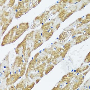 CASQ2 / Calsequestrin 2 Antibody - Immunohistochemistry of paraffin-embedded Mouse heart using CASQ2 Polyclonal Antibody at dilution of 1:100 (40x lens).