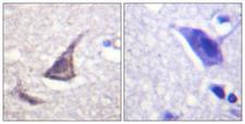 CASR/Calcium Sensing Receptor Antibody - Immunohistochemistry analysis of paraffin-embedded human brain tissue, using Calcium Sensing Receptor Antibody. The picture on the right is blocked with the synthesized peptide.