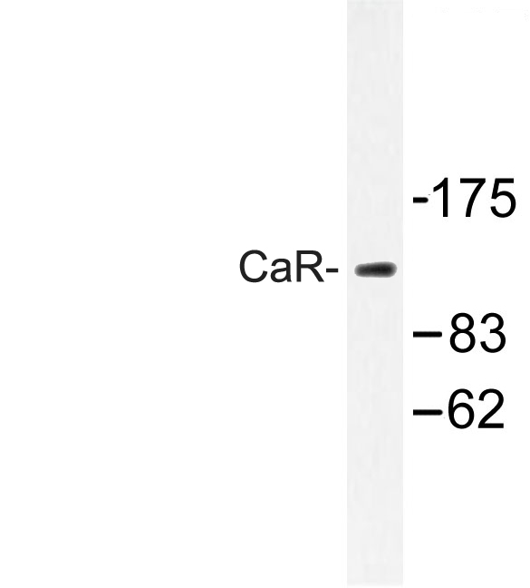 CASR/Calcium Sensing Receptor Antibody - Western blot of CaSR (A884) pAb in extracts from LOVO cells.