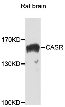 CASR/Calcium Sensing Receptor Antibody - Western blot analysis of extracts of rat brain, using CASR antibody at 1:1000 dilution. The secondary antibody used was an HRP Goat Anti-Rabbit IgG (H+L) at 1:10000 dilution. Lysates were loaded 25ug per lane and 3% nonfat dry milk in TBST was used for blocking. An ECL Kit was used for detection and the exposure time was 30s.
