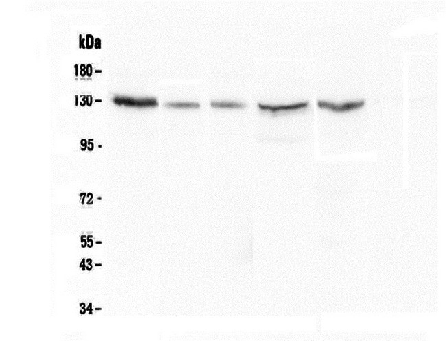 CASR/Calcium Sensing Receptor Antibody - Western blot analysis of CASR using anti-CASR antibody. Electrophoresis was performed on a 8% SDS-PAGE gel at 70V (Stacking gel) / 90V (Resolving gel) for 2-3 hours. The sample well of each lane was loaded with 50ug of sample under reducing conditions. Lane 1: human Hela whole cell lysate,Lane 2: human A549 whole cell lysate,Lane 3: human 22RV1 whole cell lysate,Lane 4: human HepG2 whole cell lysate,Lane 5: human Caco-2 whole cell lysate. After Electrophoresis, proteins were transferred to a Nitrocellulose membrane at 150mA for 50-90 minutes. Blocked the membrane with 5% Non-fat Milk/ TBS for 1.5 hour at RT. The membrane was incubated with mouse anti-CASR antigen affinity purified monoclonal antibody at 0.5 µg/mL overnight at 4°C, then washed with TBS-0.1% Tween 3 times with 5 minutes each and probed with a goat anti-mouse IgG-HRP secondary antibody at a dilution of 1:10000 for 1.5 hour at RT. The signal is developed using an Enhanced Chemiluminescent detection (ECL) kit with Tanon 5200 system.