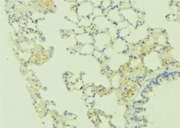 CASR/Calcium Sensing Receptor Antibody - 1:100 staining human lung tissue by IHC-P. The sample was formaldehyde fixed and a heat mediated antigen retrieval step in citrate buffer was performed. The sample was then blocked and incubated with the antibody for 1.5 hours at 22°C. An HRP conjugated goat anti-rabbit antibody was used as the secondary.