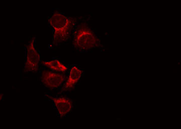 CASR/Calcium Sensing Receptor Antibody - Staining LOVO cells by IF/ICC. The samples were fixed with PFA and permeabilized in 0.1% Triton X-100, then blocked in 10% serum for 45 min at 25°C. The primary antibody was diluted at 1:200 and incubated with the sample for 1 hour at 37°C. An Alexa Fluor 594 conjugated goat anti-rabbit IgG (H+L) Ab, diluted at 1/600, was used as the secondary antibody.