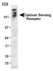 CASR/Calcium Sensing Receptor Antibody - Detection of Calcium Sensing Receptor in transfected 293 cell lysate. ECL exposure, 5 minutes. In this photo, the protein has aggregated and thus the higher MW band as expected.  This image was taken for the unconjugated form of this product. Other forms have not been tested.
