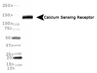 CASR/Calcium Sensing Receptor Antibody - Calcium Sensing Receptor Antibody (HL 1499) - Western blot analysis of Calcium Sensing Receptor expression in rat kidney tissue.  This image was taken for the unconjugated form of this product. Other forms have not been tested.