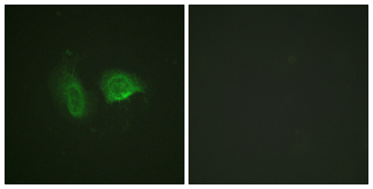 CASR/Calcium Sensing Receptor Antibody - Immunofluorescence analysis of HeLa cells, using Calcium Sensing Receptor (Phospho-Thr888) Antibody. The picture on the right is blocked with the phospho peptide.