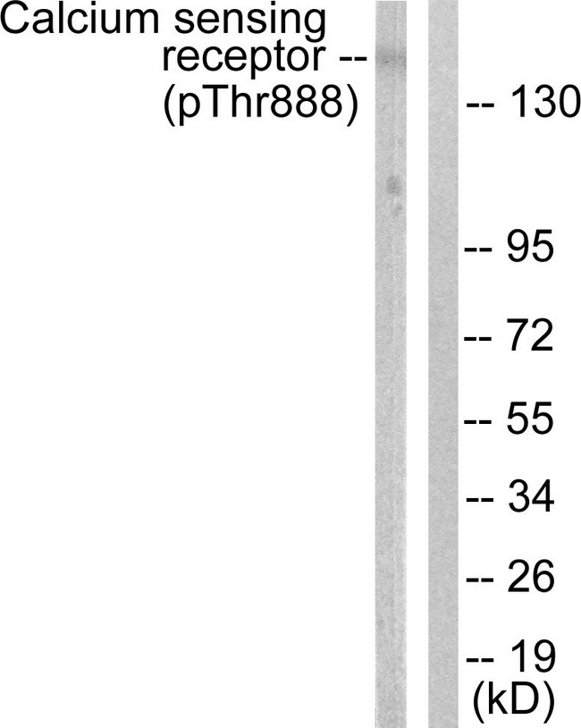 CASR/Calcium Sensing Receptor Antibody - Western blot analysis of lysates from LOVO cells, using Calcium Sensing Receptor (Phospho-Thr888) Antibody. The lane on the right is blocked with the phospho peptide.