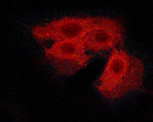 CASR/Calcium Sensing Receptor Antibody - Staining HeLa cells by IF/ICC. The samples were fixed with PFA and permeabilized in 0.1% saponin prior to blocking in 10% serum for 45 min at 37°C. The primary antibody was diluted 1/400 and incubated with the sample for 1 hour at 37°C. A Alexa Fluor 594 conjugated goat polyclonal to rabbit IgG (H+L), diluted 1/600 was used as secondary antibody.