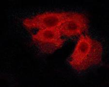 CASR/Calcium Sensing Receptor Antibody - Staining HeLa cells by IF/ICC. The samples were fixed with PFA and permeabilized in 0.1% saponin prior to blocking in 10% serum for 45 min at 37°C. The primary antibody was diluted 1/400 and incubated with the sample for 1 hour at 37°C. A Alexa Fluor 594 conjugated goat polyclonal to rabbit IgG (H+L), diluted 1/600 was used as secondary antibody.