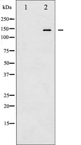 CASR/Calcium Sensing Receptor Antibody - Western blot analysis of Calcium Sensing Receptor phosphorylation expression in LOVO cells whole cells lysates. The lane on the left is treated with the antigen-specific peptide.