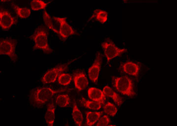 CASR/Calcium Sensing Receptor Antibody - Staining LOVO cells by IF/ICC. The samples were fixed with PFA and permeabilized in 0.1% Triton X-100, then blocked in 10% serum for 45 min at 25°C. The primary antibody was diluted at 1:200 and incubated with the sample for 1 hour at 37°C. An Alexa Fluor 594 conjugated goat anti-rabbit IgG (H+L) Ab, diluted at 1/600, was used as the secondary antibody.