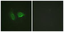 CASR/Calcium Sensing Receptor Antibody - P-peptide - + Immunofluorescence analysis of HeLa cells, using Calcium Sensing Receptor (Phospho-Thr888) antibody.