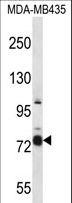 CASS4 Antibody - CASS4 Antibody western blot of MDA-MB435 cell line lysates (35 ug/lane). The CASS4 antibody detected the CASS4 protein (arrow).