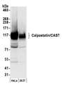 CAST / Calpastatin Antibody - Detection of human Calpastatin/CAST by western blot. Samples: Whole cell lysate (50 µg) from HeLa and 293T cells prepared using NETN lysis buffer. Antibody: Affinity purified rabbit anti-Calpastatin/CAST antibody used for WB at 0.1 µg/ml. Detection: Chemiluminescence with an exposure time of 10 seconds.