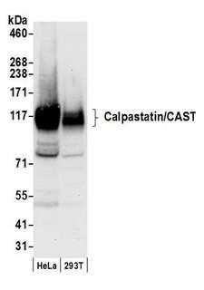 CAST / Calpastatin Antibody - Detection of human Calpastatin/CAST by western blot. Samples: Whole cell lysate (50 µg) from HeLa and 293T cells prepared using NETN lysis buffer. Antibody: Affinity purified rabbit anti-Calpastatin/CAST antibody used for WB at 0.1 µg/ml. Detection: Chemiluminescence with an exposure time of 10 seconds.