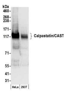 CAST / Calpastatin Antibody - Detection of human Calpastatin/CAST by western blot. Samples: Whole cell lysate (50 µg) from HeLa and 293T cells prepared using NETN lysis buffer. Antibody: Affinity purified rabbit anti-Calpastatin/CAST antibody used for WB at 0.1 µg/ml. Detection: Chemiluminescence with an exposure time of 3 seconds.