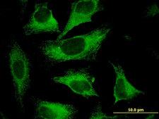 CAST / Calpastatin Antibody - Immunofluorescence of monoclonal antibody to CAST on HeLa cell . [antibody concentration 10 ug/ml]