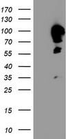 CAST / Calpastatin Antibody - HEK293T cells were transfected with the pCMV6-ENTRY control (Left lane) or pCMV6-ENTRY CAST (Right lane) cDNA for 48 hrs and lysed. Equivalent amounts of cell lysates (5 ug per lane) were separated by SDS-PAGE and immunoblotted with anti-CAST.