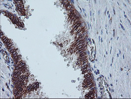 CAST / Calpastatin Antibody - IHC of paraffin-embedded Human prostate tissue using anti-CAST mouse monoclonal antibody. (Heat-induced epitope retrieval by 10mM citric buffer, pH6.0, 100C for 10min).