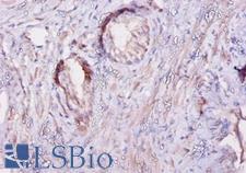 CAST / Calpastatin Antibody - Immunohistochemistry of paraffin-embedded human prostate using CAST / Calpastatin antibody at dilution of 1:10.  This image was taken for the unconjugated form of this product. Other forms have not been tested.