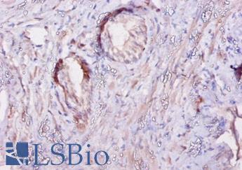 CAST / Calpastatin Antibody - Immunohistochemistry of paraffin-embedded human prostate using CAST / Calpastatin antibody at dilution of 1:10.  This image was taken for the unconjugated form of this product. Other forms have not been tested.