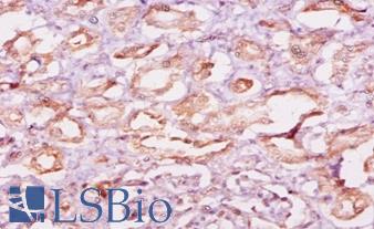 CAST / Calpastatin Antibody - Immunohistochemistry of paraffin-embedded human kidney using CAST / Calpastatin antibody at dilution of 1:10.  This image was taken for the unconjugated form of this product. Other forms have not been tested.