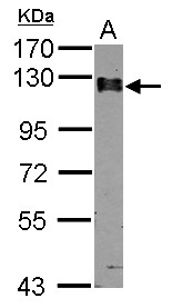 CAST / Calpastatin Antibody - Sample (30 ug of whole cell lysate) A: A549 7.5% SDS PAGE CAST / Calpastatin antibody diluted at 1:2000