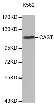 CAST / Calpastatin Antibody - Western blot analysis of extracts of K562 cell line, using CAST antibody.
