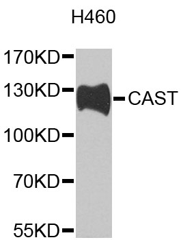 CAST / Calpastatin Antibody - Western blot analysis of extracts of H460 cells, using CAST antibody at 1:1000 dilution. The secondary antibody used was an HRP Goat Anti-Rabbit IgG (H+L) at 1:10000 dilution. Lysates were loaded 25ug per lane and 3% nonfat dry milk in TBST was used for blocking. An ECL Kit was used for detection and the exposure time was 90s.