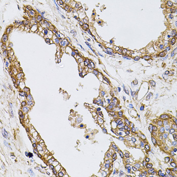 CAST / Calpastatin Antibody - Immunohistochemistry of paraffin-embedded human prostate using CAST antibodyat dilution of 1:100 (40x lens).