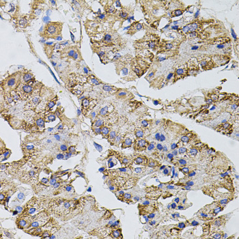 CAST / Calpastatin Antibody - Immunohistochemistry of paraffin-embedded human stomach using CAST antibodyat dilution of 1:100 (40x lens).
