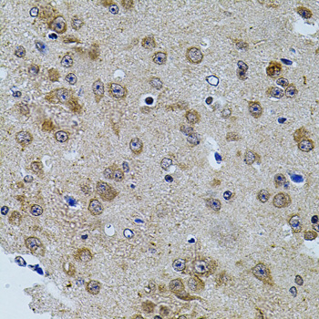 CAST / Calpastatin Antibody - Immunohistochemistry of paraffin-embedded mouse brain using CAST antibodyat dilution of 1:100 (40x lens).