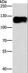 CAST / Calpastatin Antibody - Western blot analysis of Lovo cell, using CAST Polyclonal Antibody at dilution of 1:750.